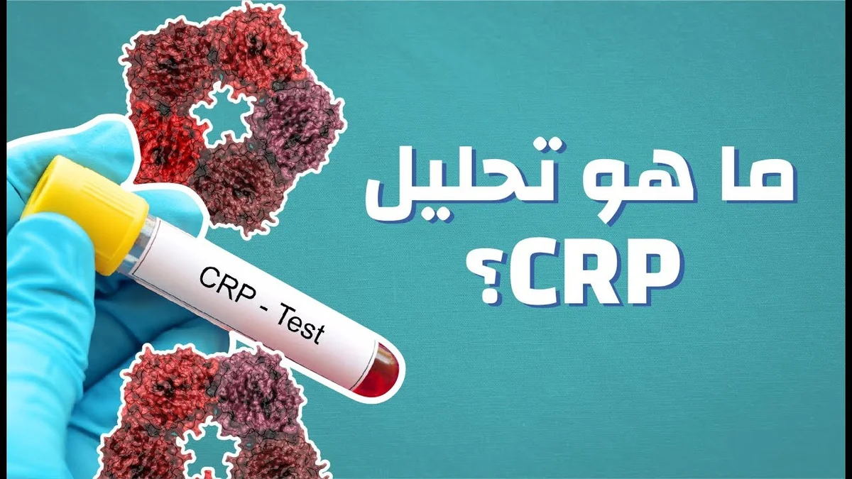 ما هو تحليل الـ CRP