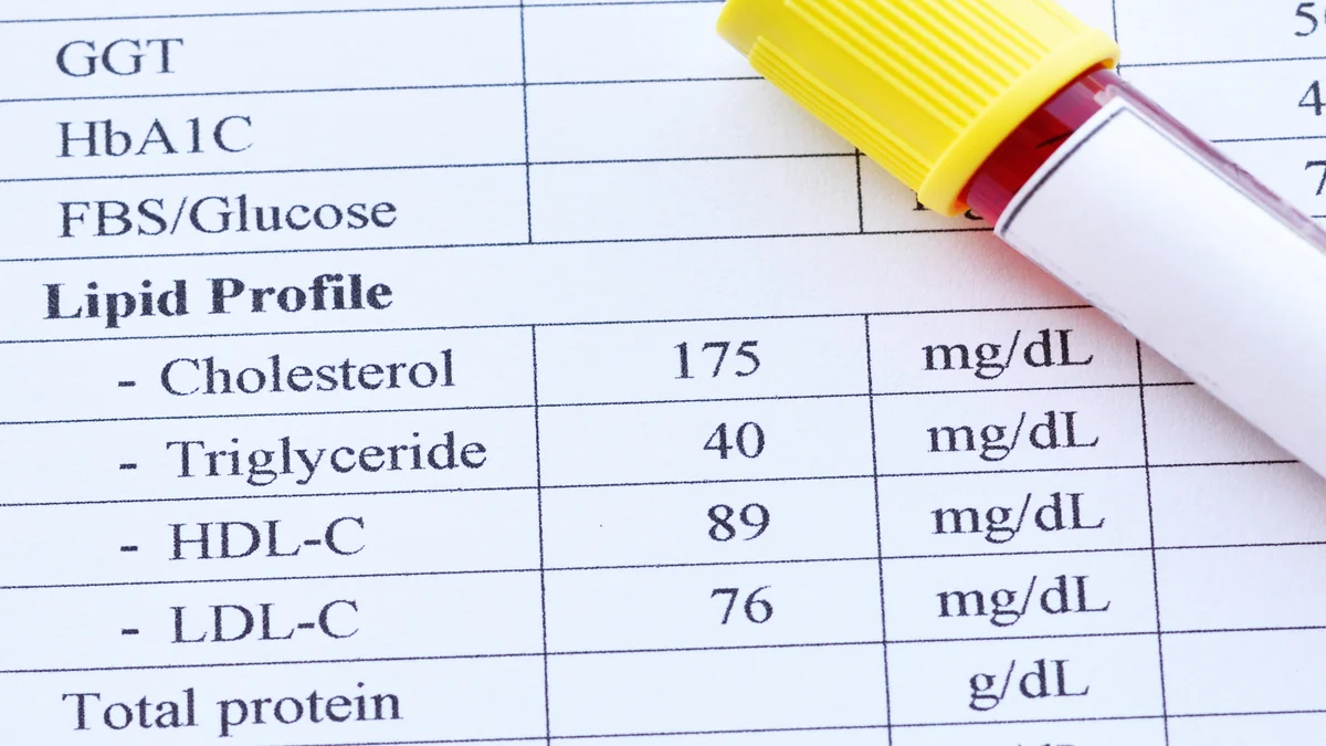 lipid profile ما هو تحليل