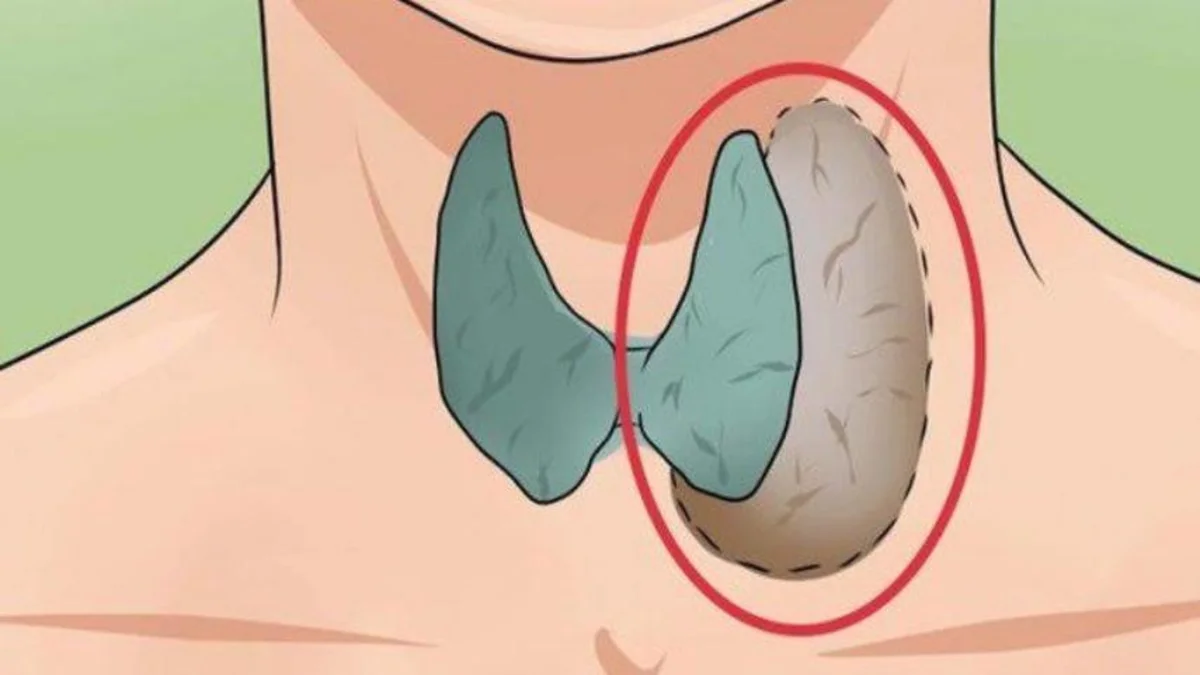 أعراض خمول الغدة الدرقية