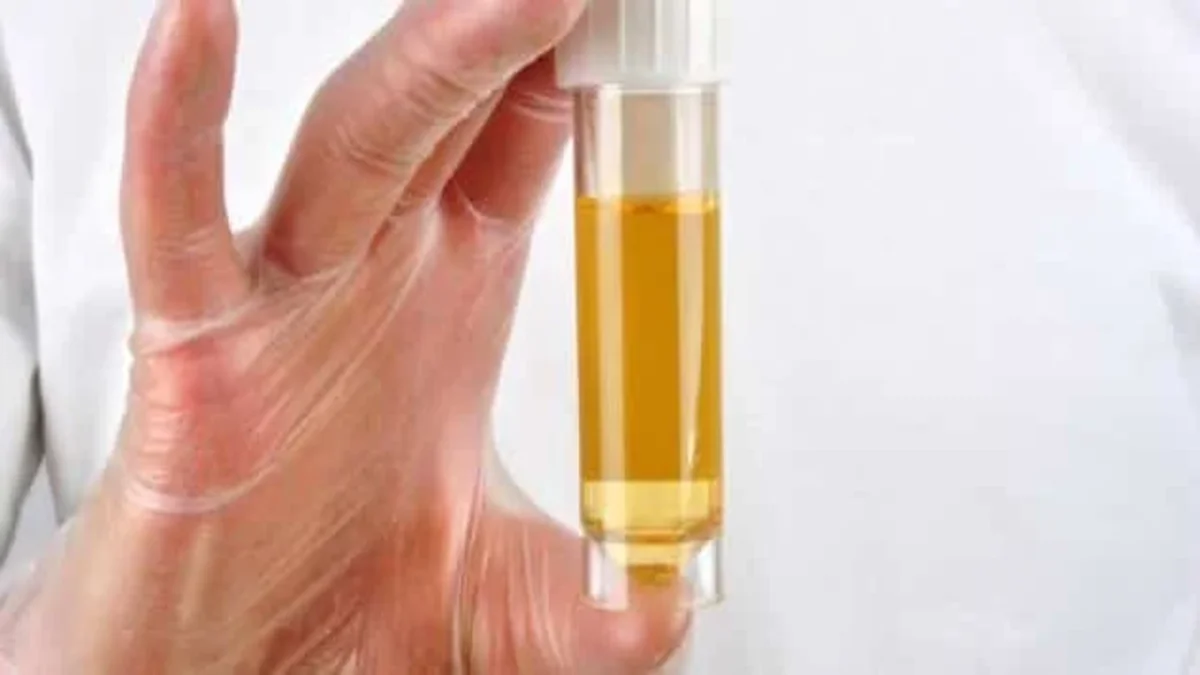 تحليل pus cells 4 6