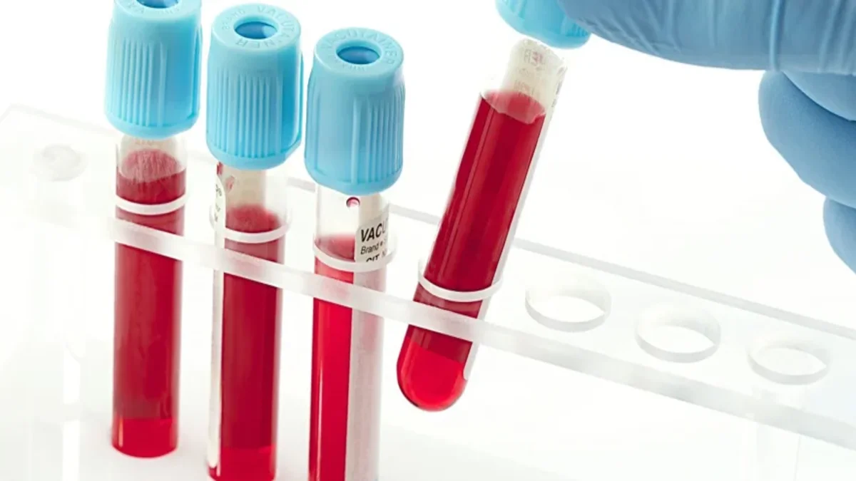 تحليل rubella igg positive