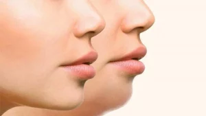 أفضل أكلات لتسمين الوجه