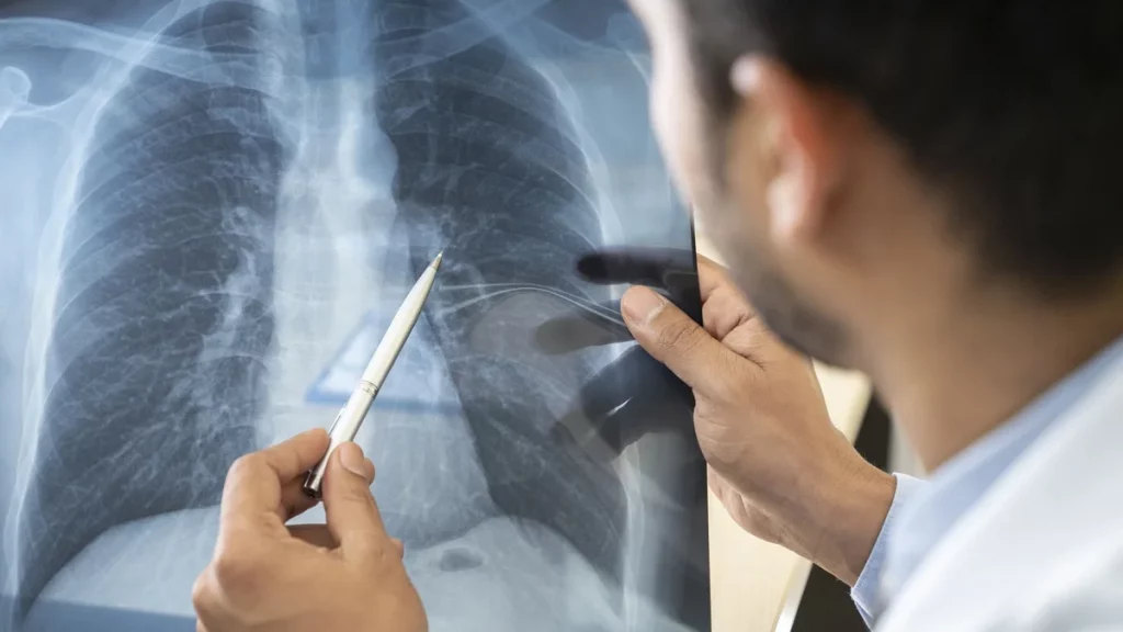  تخصص طب أمراض الرئة